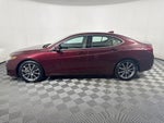2016 Acura TLX V6 Tech